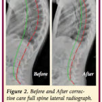 Chiropractic X Ray Report Template