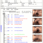 Drainage Report Template