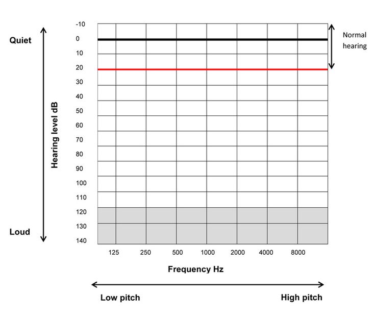 Blank Audiogram Template Download