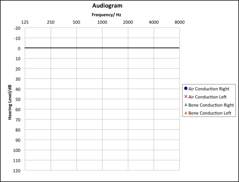 Blank Audiogram Template Download (3) TEMPLATES EXAMPLE TEMPLATES Blank Audiogram Template Download (3) TEMPLATES EXAMPLE TEMPLATES