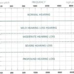 Blank Audiogram Template Download