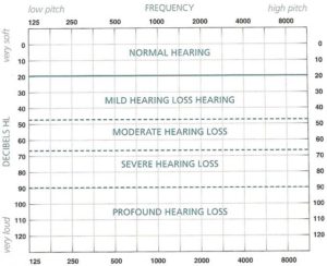 Blank Audiogram Template Download (5) - TEMPLATES EXAMPLE | TEMPLATES