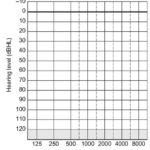 Blank Audiogram Template Download